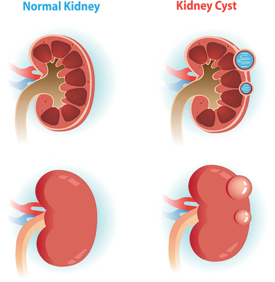 Kidney PNG Wallpapers
