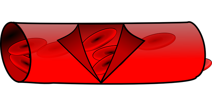 Blood_ Vessel_ Atherosclerosis_ Illustration.jpg PNG with transparent background