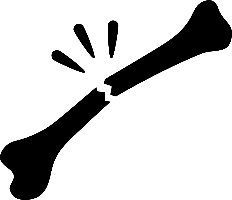 Broken Bone Graphic Illustration PNG with transparent background