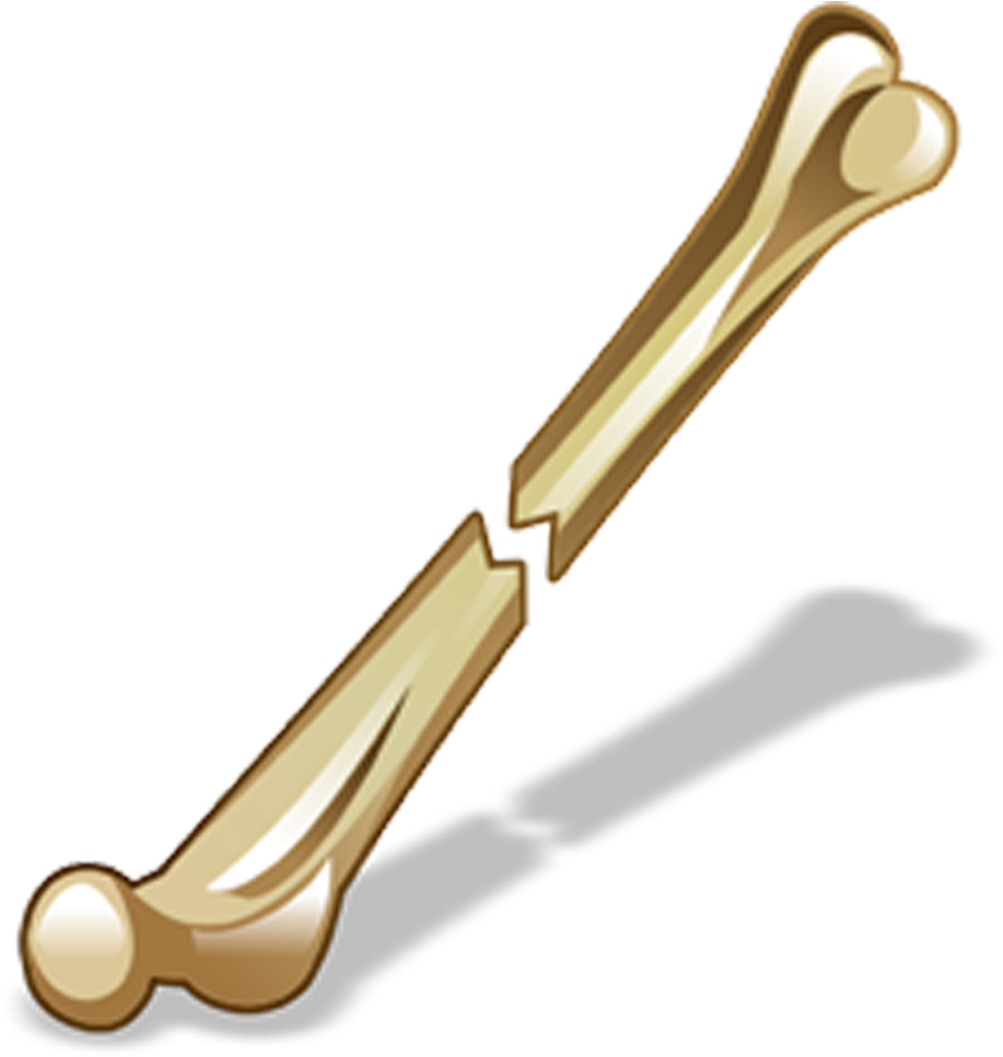Broken Bone Graphic PNG with transparent background