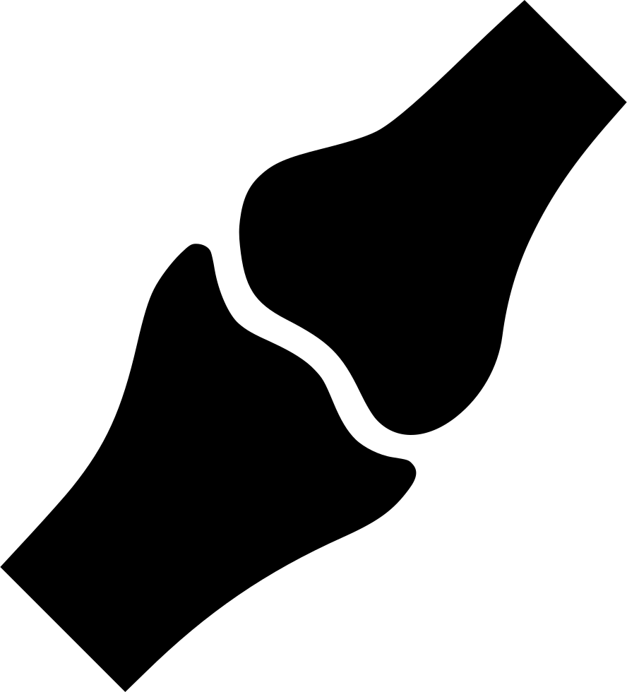 Broken Bone Xray Image PNG with transparent background