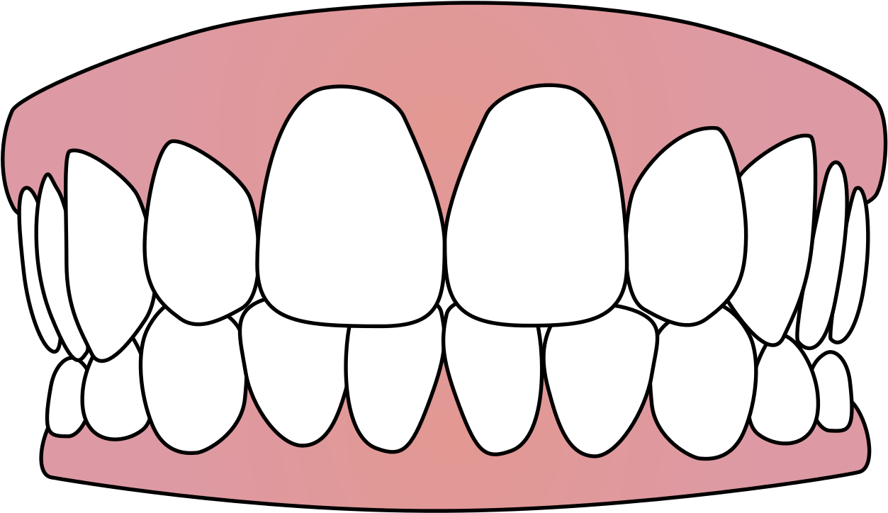 Free Vector Download Png Tooth - Teeth Svg, Transparent Png PNG with transparent background