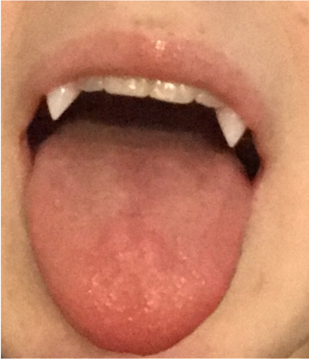 Close Up Tongue Piercing