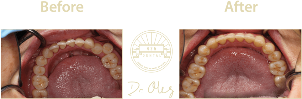 Dental_ Treatment_ Before_ After_ Dr_ Olly