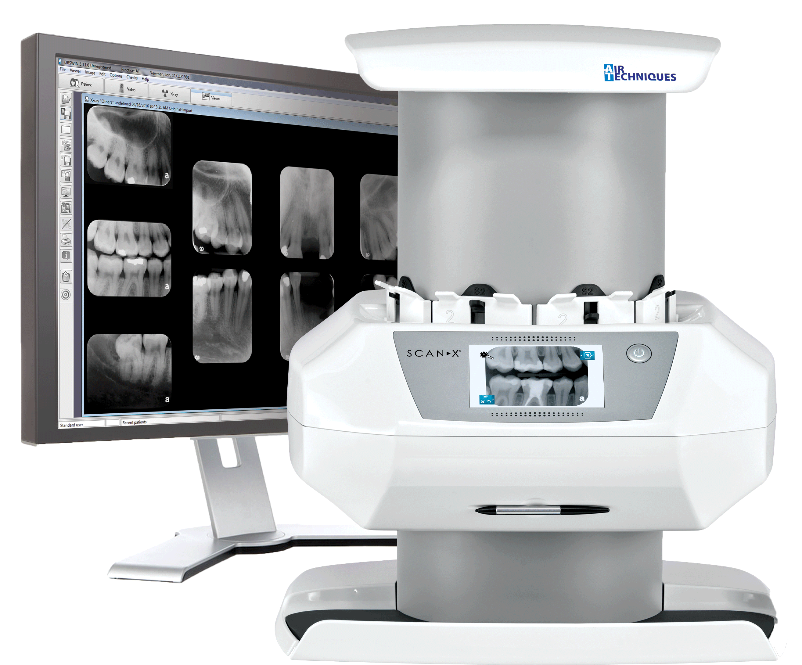 Dental Xray Scannerand Monitor Setup