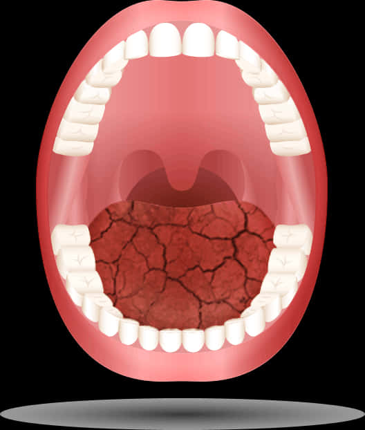 Dry Mouth Illustration