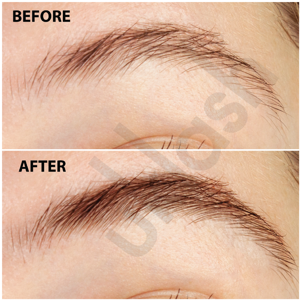 Eyebrow Transformation Before After PNG image with a transparent background, free high-resolution download