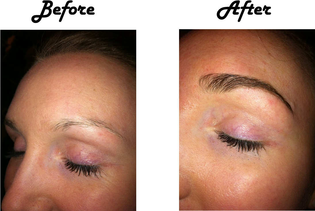 Eyebrow_ Transformation_ Before_ After.png PNG with transparent background
