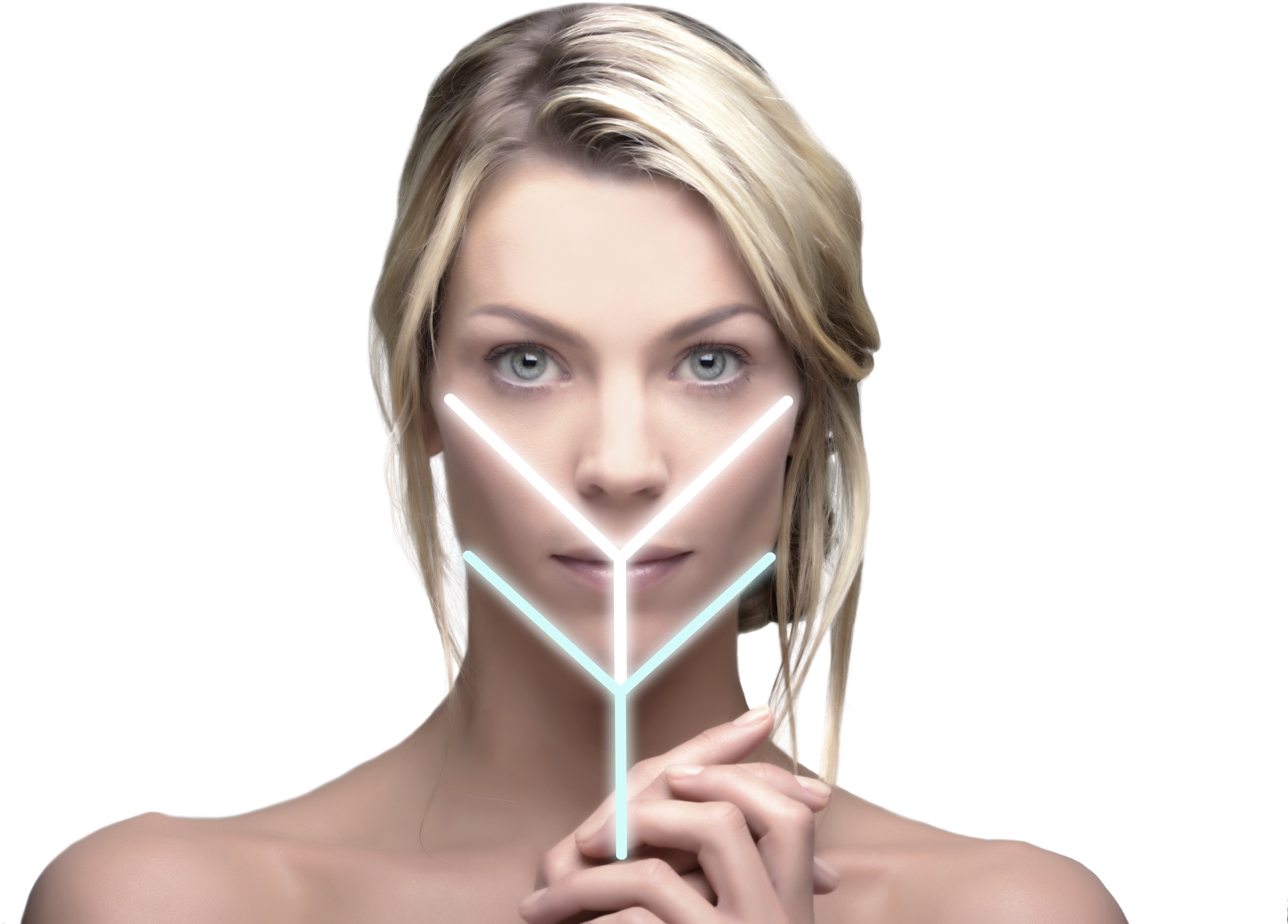 Y Lift Facelift Procedure, HD Png Download PNG with transparent background