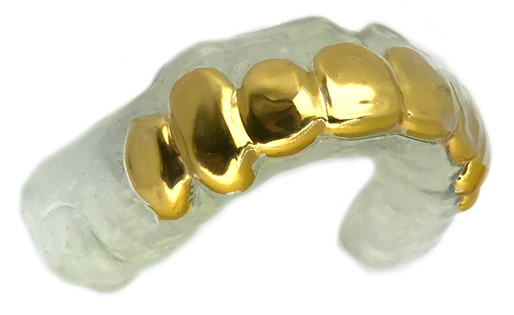 Gold Grillz Mouthguard - Gum Shield Grillz, HD Png Download PNG with transparent background