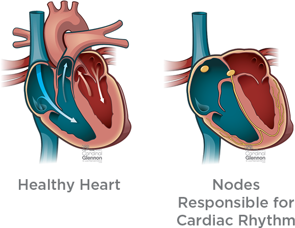 Healthy Heartand Cardiac Rhythm Nodes