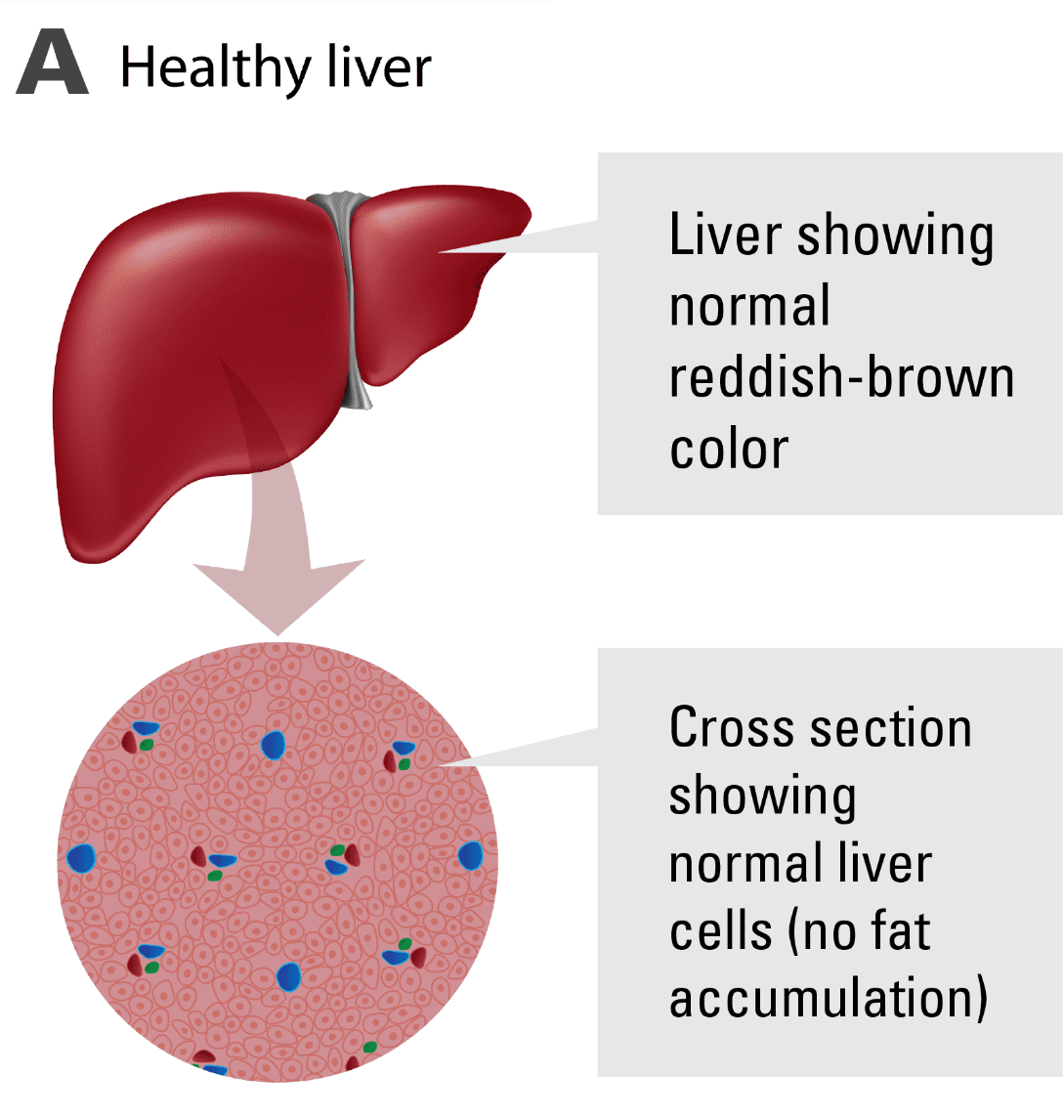 Healthy Liver Structureand Cells PNG with transparent background
