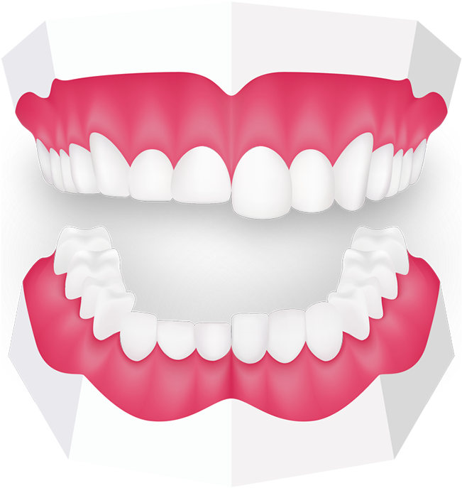 Custom Made Mouth Guard, HD Png Download PNG with transparent background