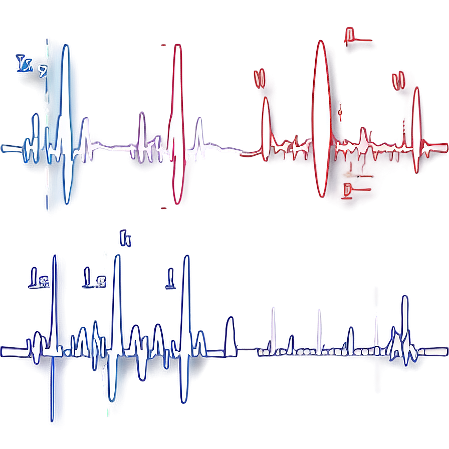 Heartbeat Ekg For Fitness Png Hda49