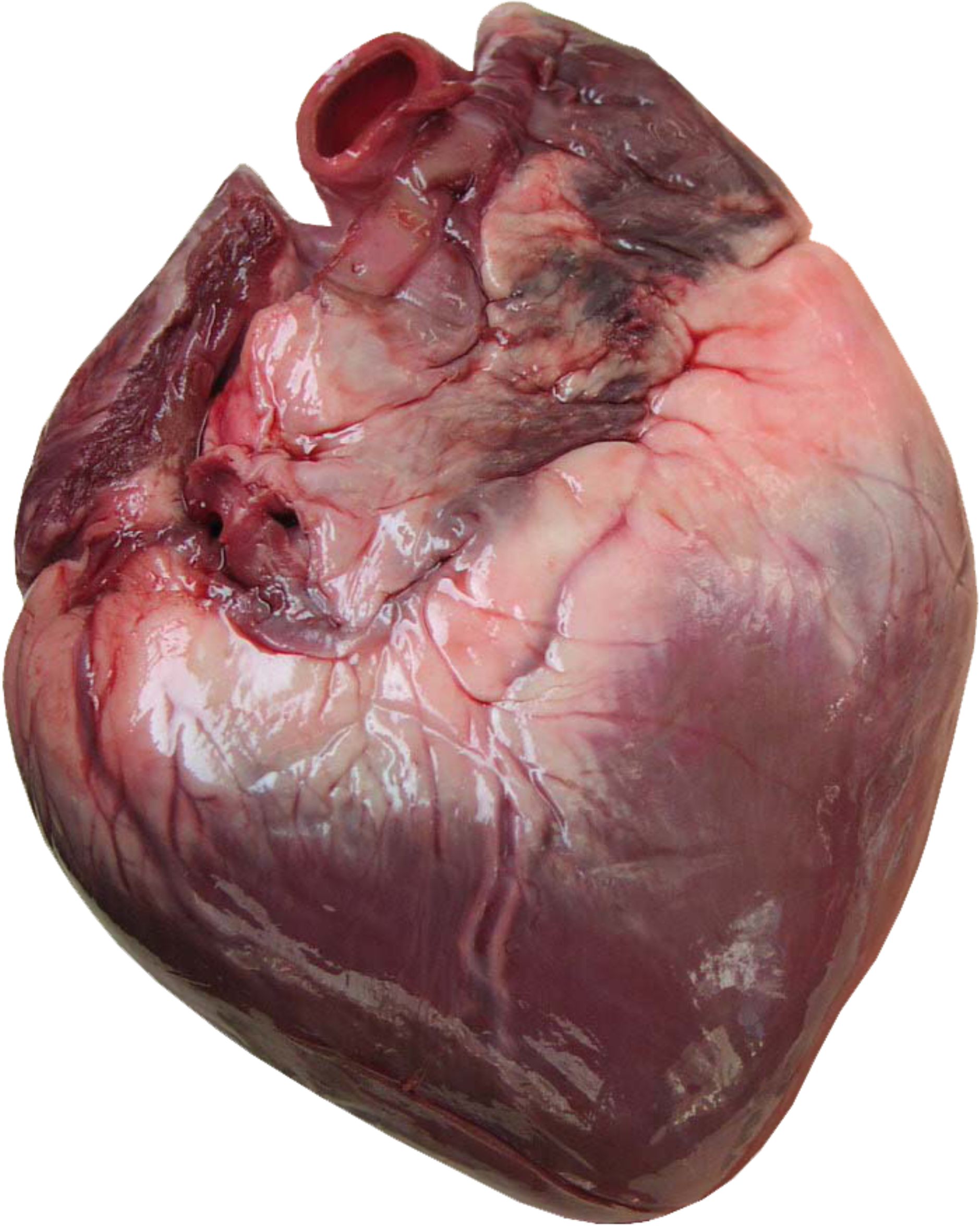 Human Heart Anatomy