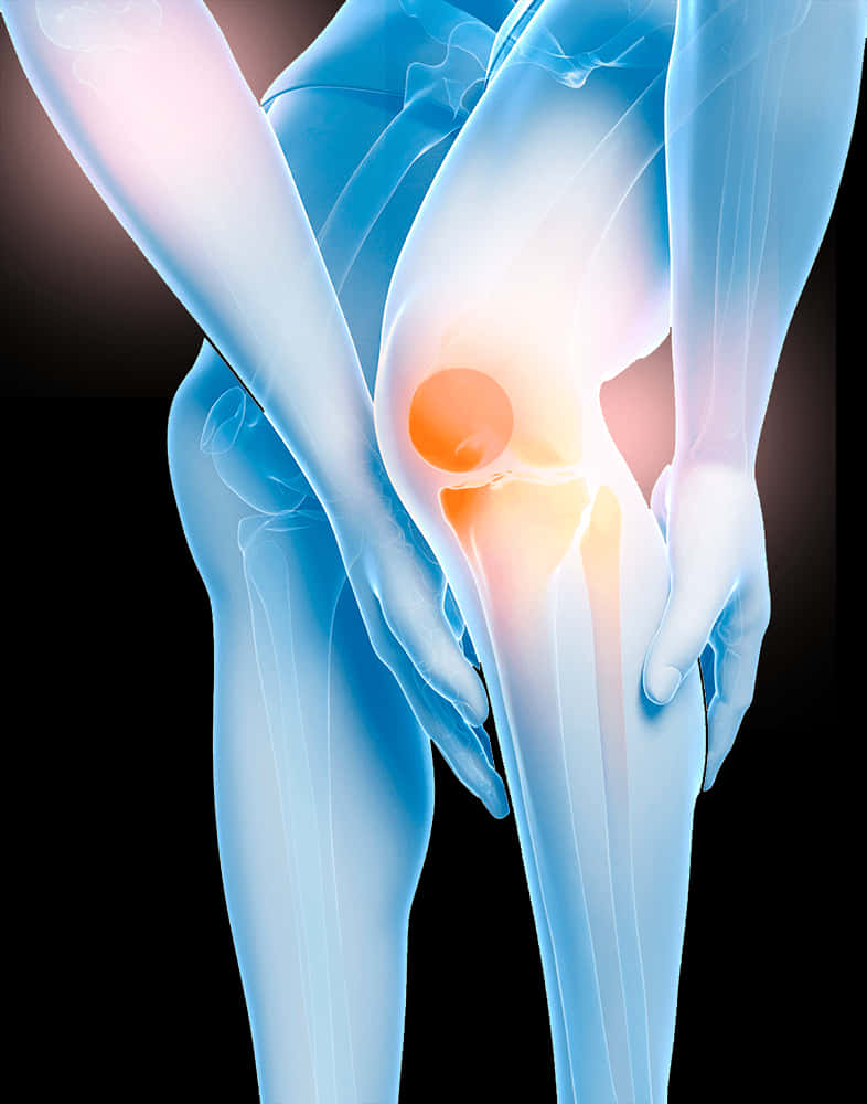 Knee Pain Illustration.jpg