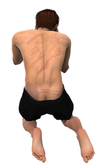 Man_with_ Scars_on_ Back