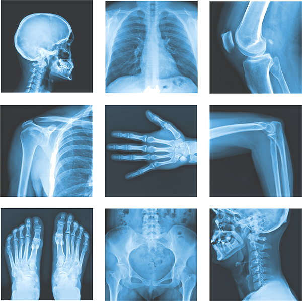 Medical_ X Ray_ Collage PNG image with a transparent background, free high-resolution download