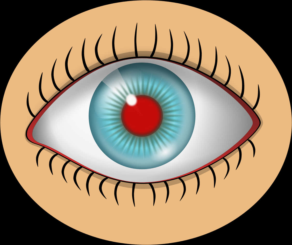 Red Eye Condition Illustration