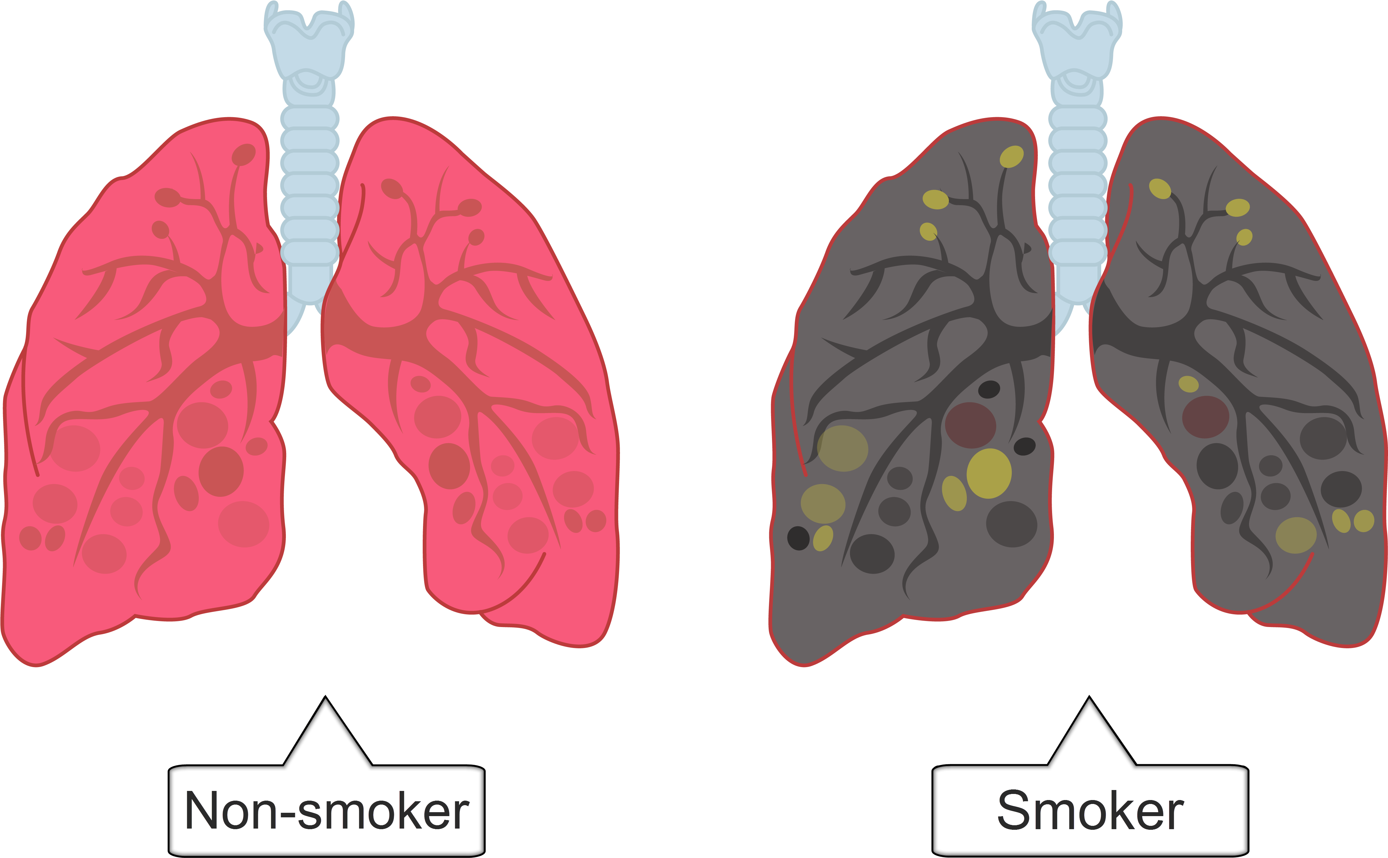 In The Lungs, The Cells That Line The Bronchi Produce - Smokers Lungs Png Transparent, Png Download PNG image with a transparent background, free high-resolution download