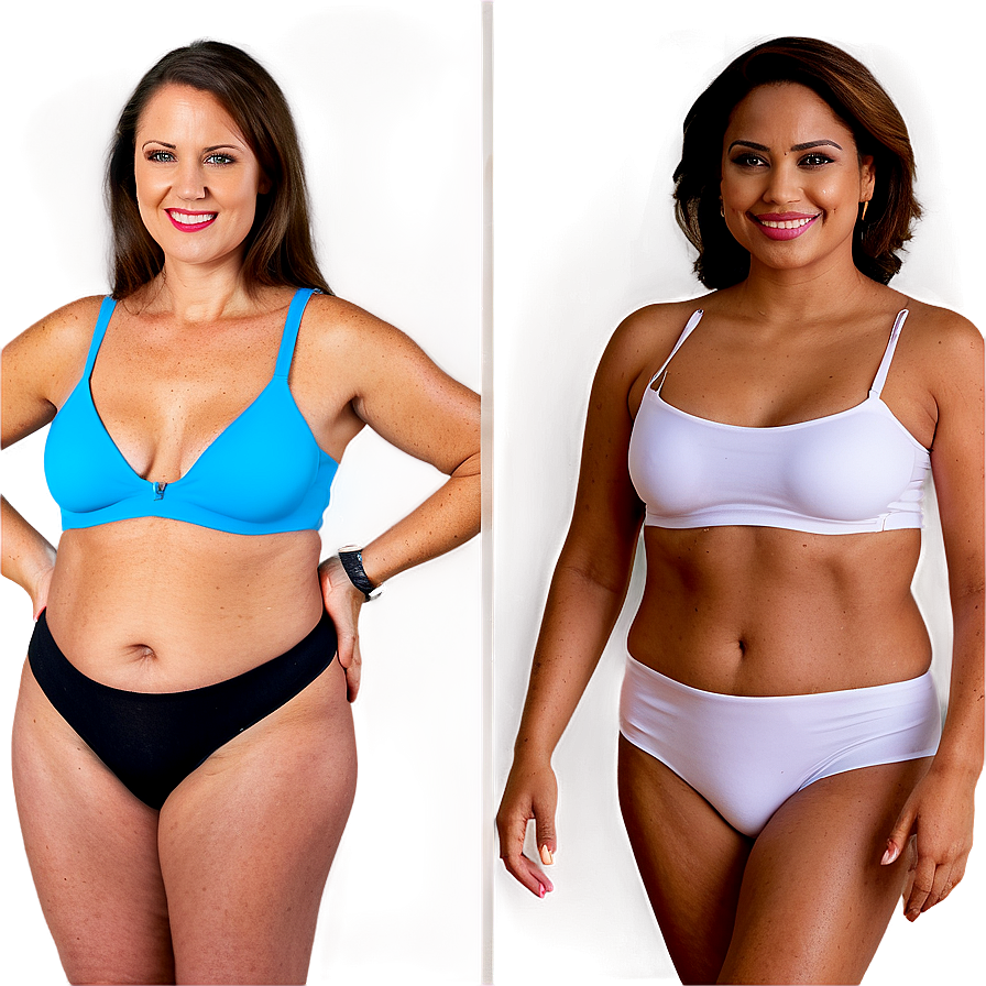 Bariatric Surgery Before And After Png 06252024 PNG Image