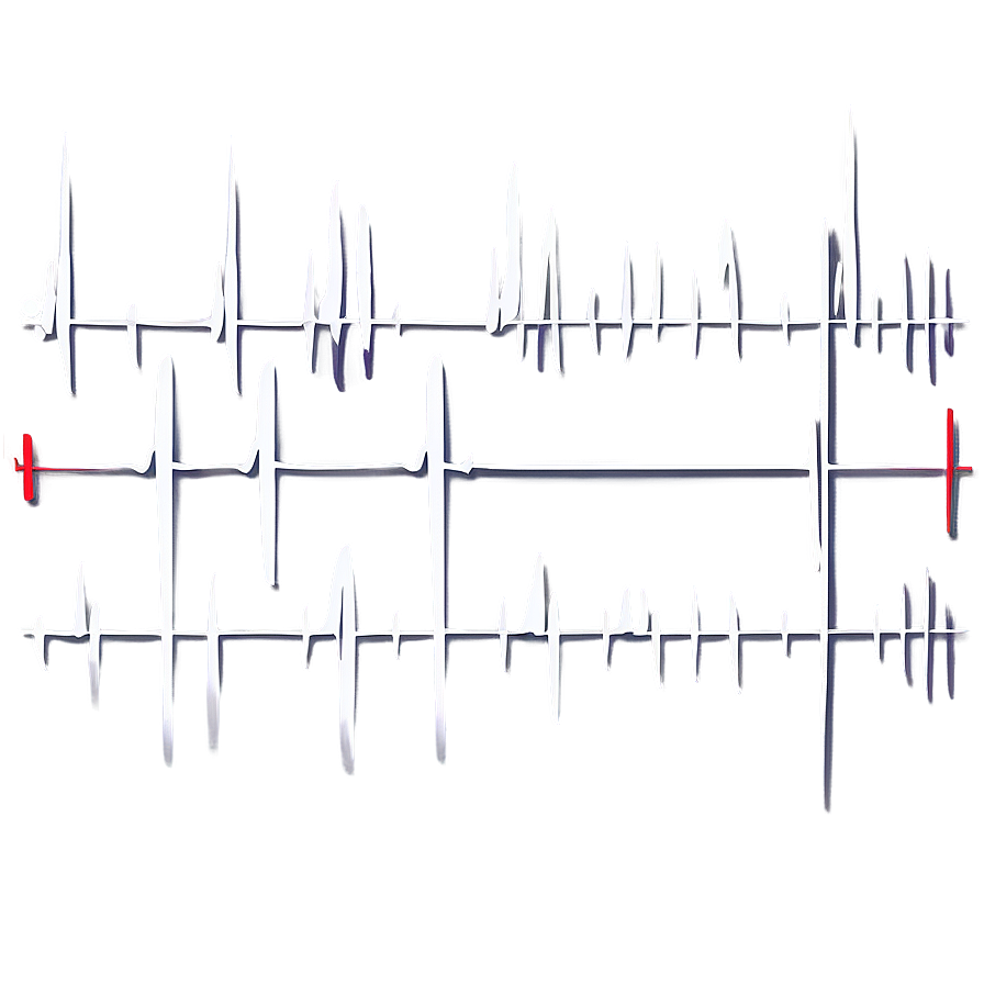 Cardiac Pulse Waveform Png 21 PNG Image