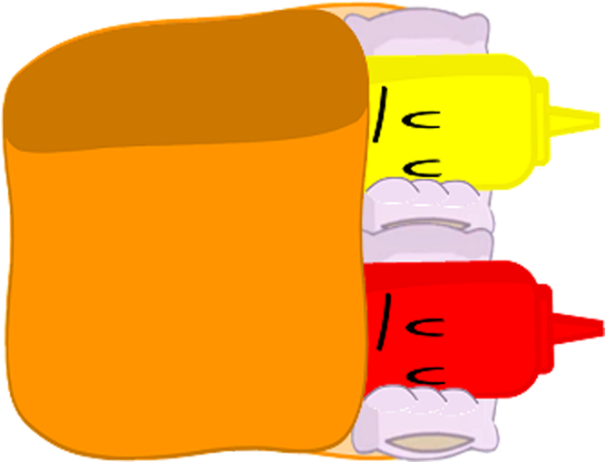 Condiment Bottles Cartoon PNG Image