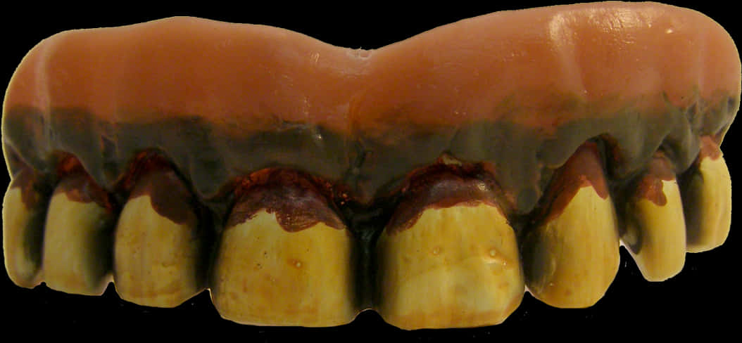 Dental Prosthesis Upper Arch PNG Image