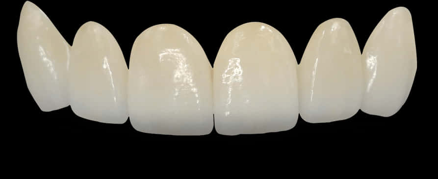 Dental Veneers Set PNG Image