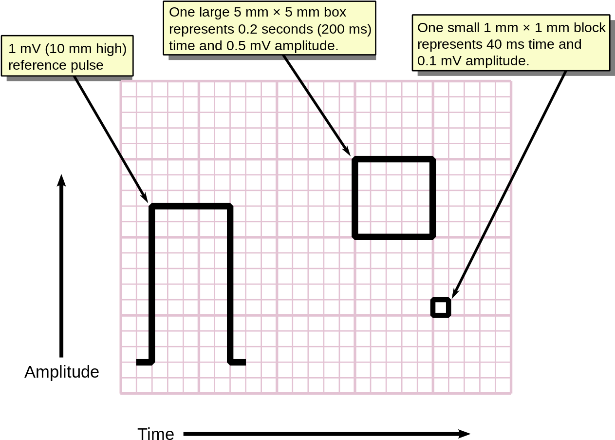 E C G Graph Paper Scale Explanation PNG Image