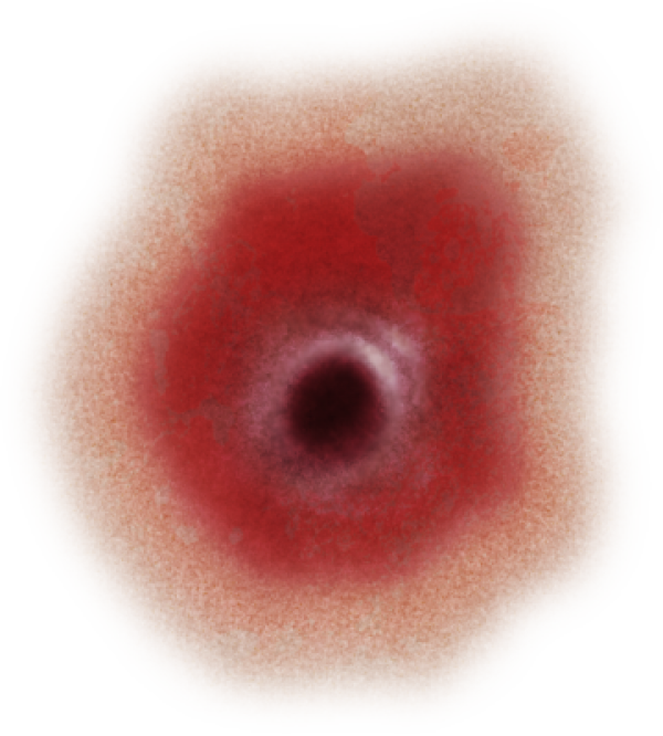 Gunshot Wound Closeup PNG Image