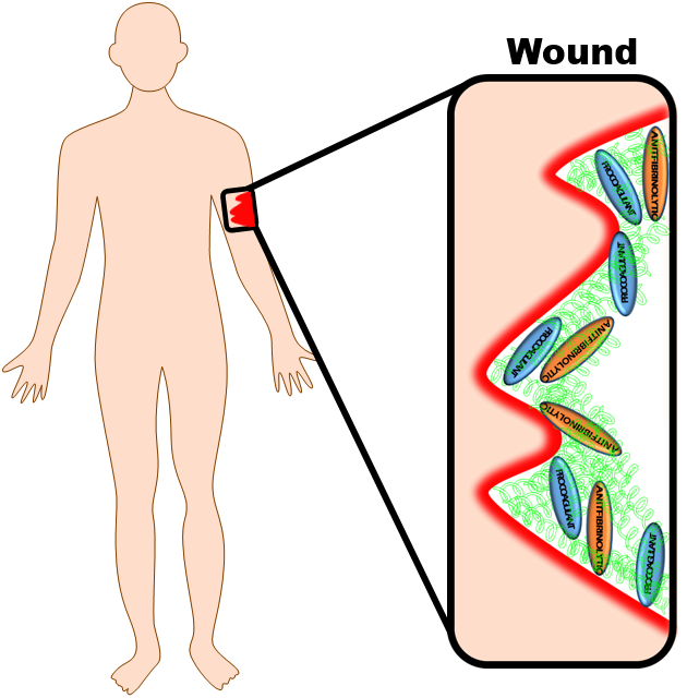 Human Anatomy Wound Diagram PNG Image