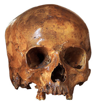 Human Skull Specimen PNG Image