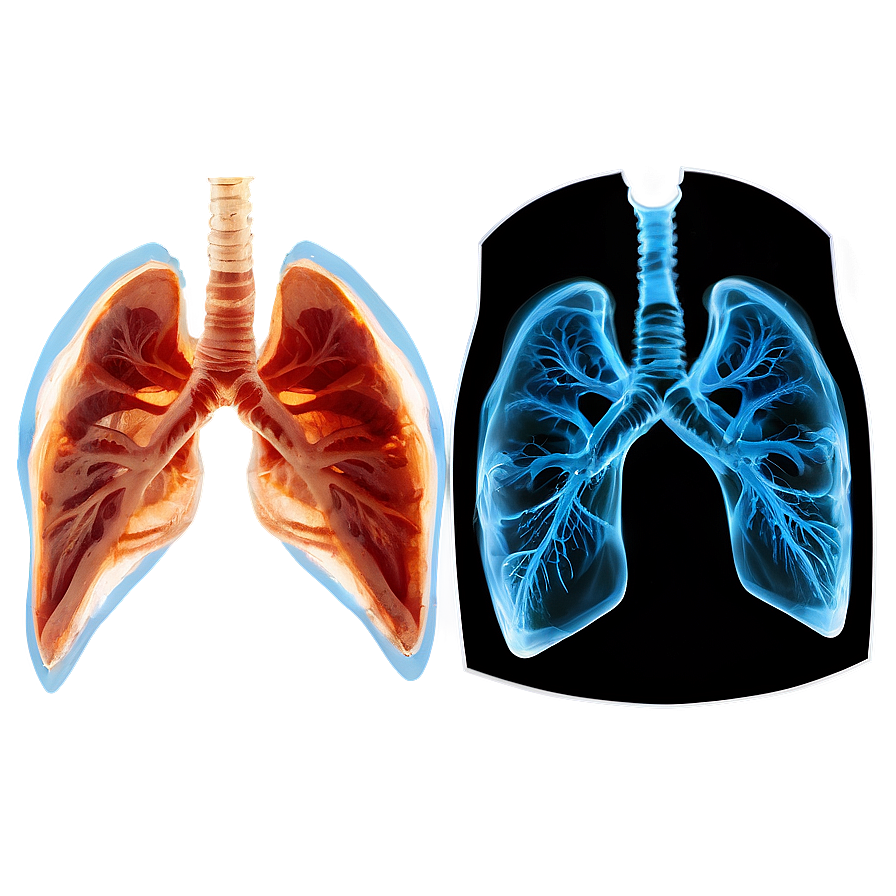 Lungs Under X-ray Png 05232024 PNG Image