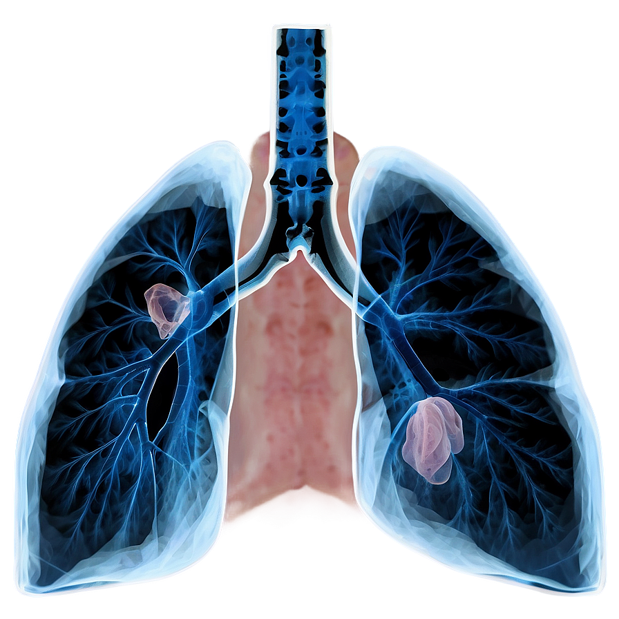 Lungs Under X-ray Png 05232024 PNG Image