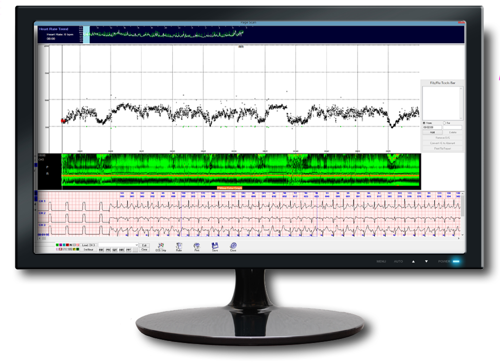 Medical Monitor Displaying Heart Rateand Sleep Data PNG Image