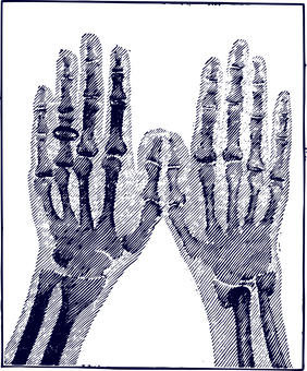 Xray Hands Bones Outline PNG Image