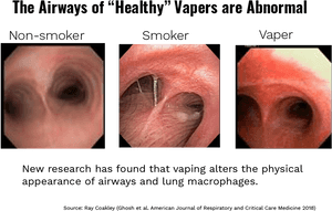 Airway Comparison Non Smoker Smoker Vaper PNG image with transparent background