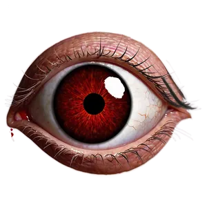 Bloodshot Eye Educational Png Stt23 PNG Image