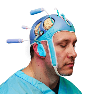 Brain Surgery Close-Up PNG 06252024 PNG with transparent background
