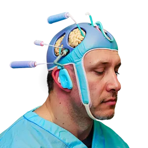 Brain Surgery Close-up Png 06252024 PNG Image