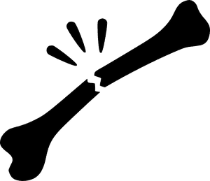 Broken Bone Graphic Illustration PNG image with transparent background