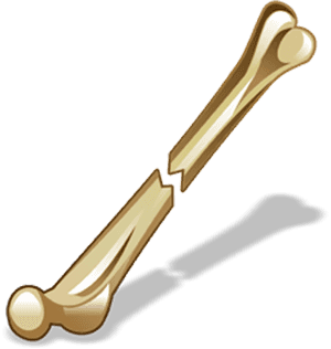 Broken Bone Graphic PNG image with transparent background