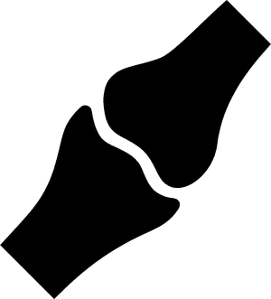 Broken Bone Xray Image PNG image with transparent background