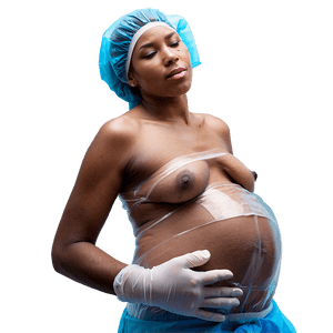 C-Section Surgery Procedure PNG its65 PNG with transparent background