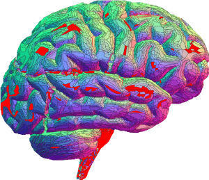 This Is What Asperger's Syndrome Is Like, HD Png Download PNG image with transparent background