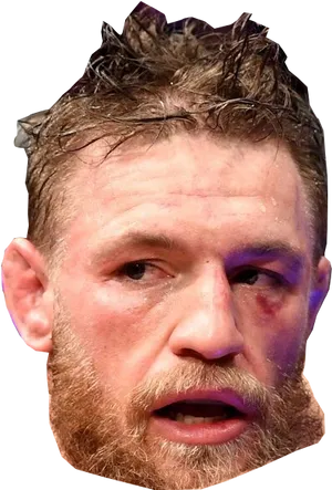 Conor Mc Gregor Intense Facial Expression PNG Image