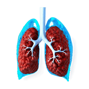Coronavirus Infected Lungs Image PNG 19 PNG image with transparent background