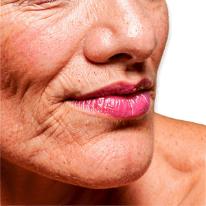 Deep Wrinkle Filler PNG kef PNG with transparent background