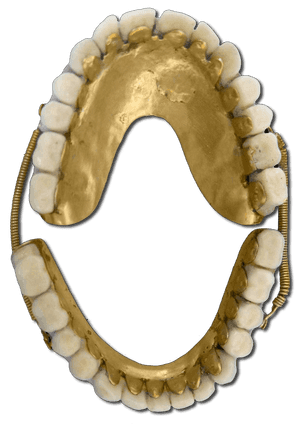 Dental Impression Gold Teeth PNG image with transparent background